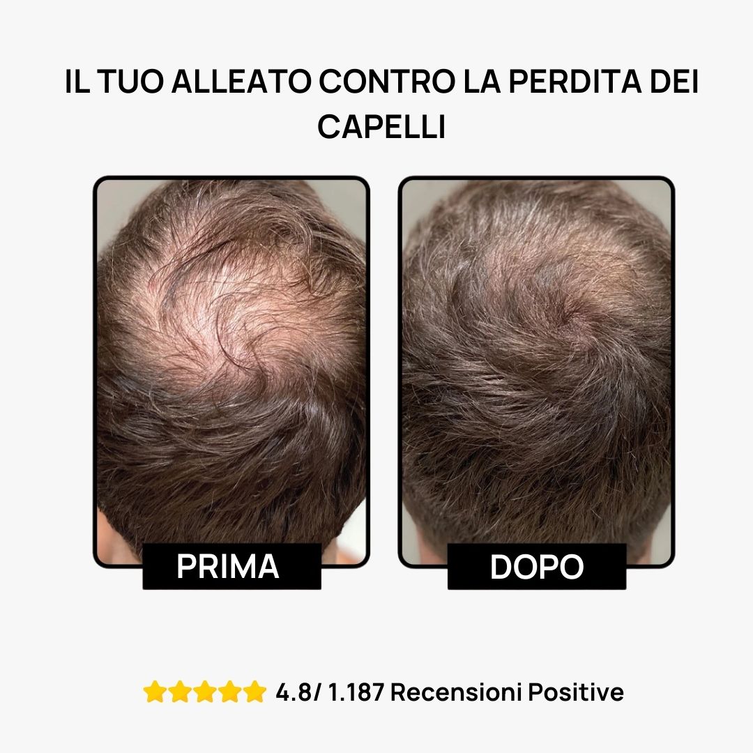 Shampoo Attivatore di Ricrescita Hairboost™