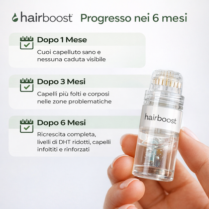 Hairboost® Sistema di Micro-Infusione Capillare per Favorire la Ricrescita dei Capelli